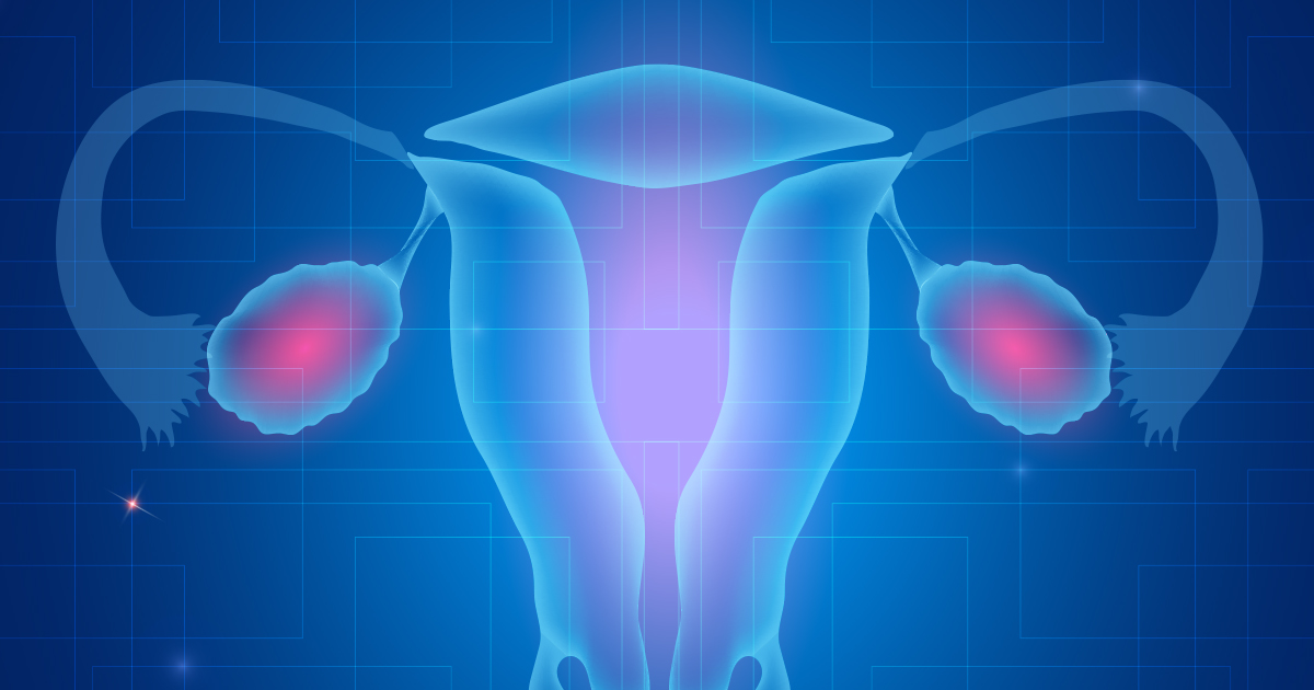 Study Fallopian tube lesions an early sign of ovarian